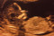 Živé organismy a anatomie